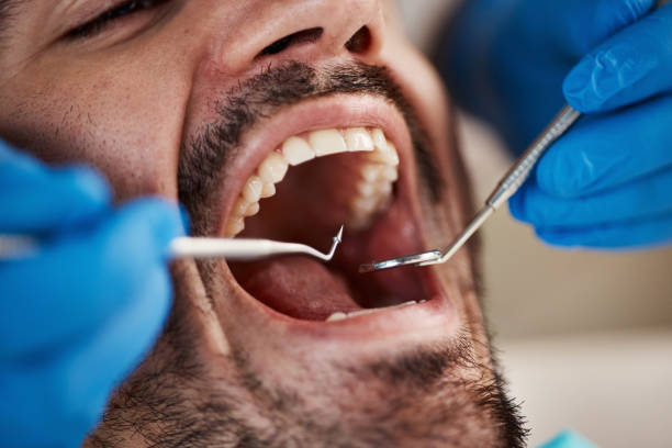 Best Broken or Chipped Tooth Repair in Rosharon, TX