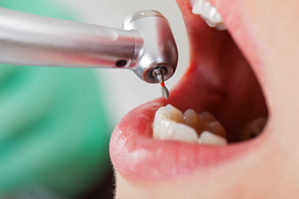 Best Emergency Cosmetic Dentistry (e.g., broken veneers) in Rosharon, TX